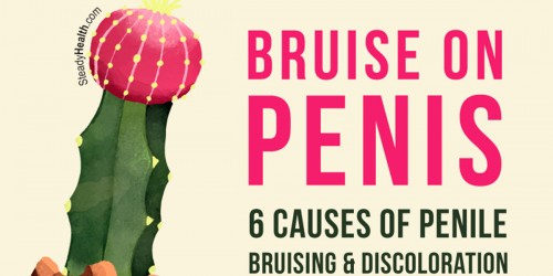 Bruise On Penis: 6 Causes Of Penile Bruising And Discoloration