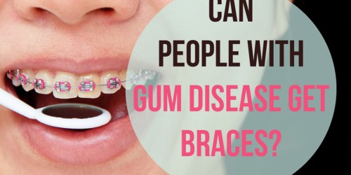 Can People With Gum Disease Get Braces?