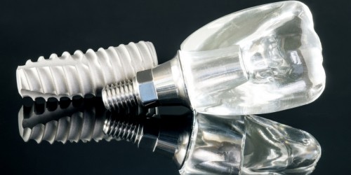 Могут ли пациенты с заболеваниями пародонта получить зубные имплантаты?