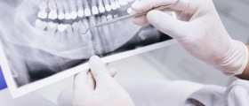 Can Root Canal Treatment Cause Cancer?