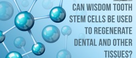 Can Wisdom Tooth Stem Cells Be Used To Regenerate Dental and Other Tissues?