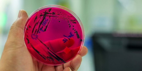 Can You Really End Up With Sepsis Due To A UTI?