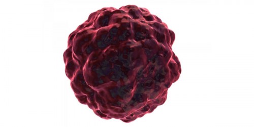 Brain Cancer - Treatment Alternatives