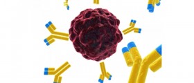 Breast Cancer Prognosis Predictor Determines Survival Rate