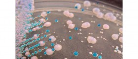 Help For Recurring Yeast Infections