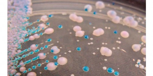 Help For Recurring Yeast Infections