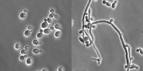 Vulvovaginal candidiasis (Vaginal thrush) therapy