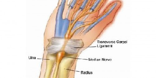 Numb hands relation to Carpal Tunnel Syndrome