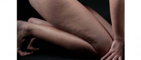 Laser Procedure Promises To Cure Cellulite In One Treatment
