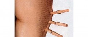 Dealing with cellulite: Beat cellulite now!