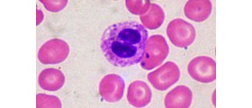 Will We Test for Cervical Cancer at Home?