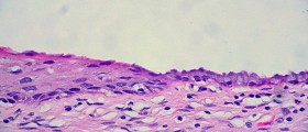 Why Check Your Cervical Mucus?