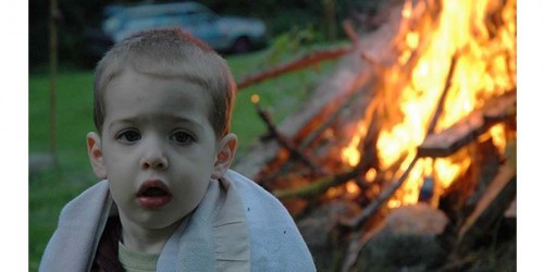 Child Safety: Burns And Scalds Care Advice