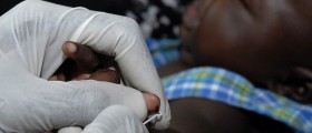 The New California Measles Vaccination Law: Tyranny or Necessity?