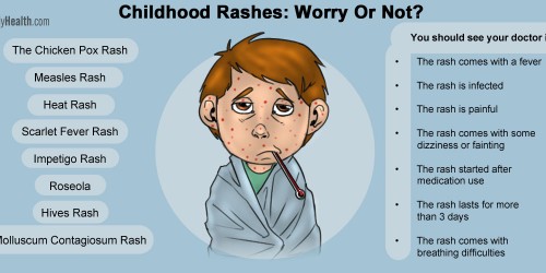 Childhood Rashes: Worry Or Not?