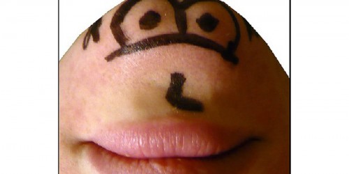 All about Chin Augmentation and Implants