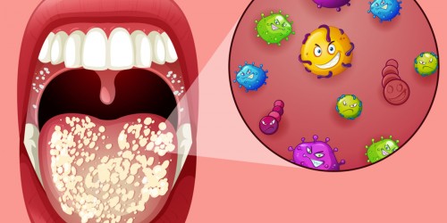 5 Common Infections In Diabetes Patients And How To Prevent Them