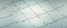 7 Common Tests You May Need Have To Diagnose A Heart Attack