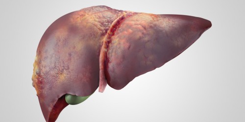 3 Complications Of Hepatitis C Everyone Should Know About