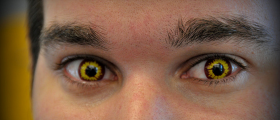 Halloween Eye Safety: Be Cautious Of Decorative Contact Lenses!