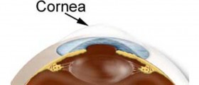 Recurrent Corneal Erosion Fact Sheet
