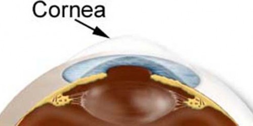 Recurrent Corneal Erosion Fact Sheet