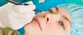 Rhytidectomy: Face Lifting procedure