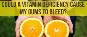 Could A Vitamin Deficiency Cause My Gums To Bleed?