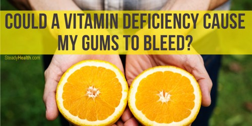 Could A Vitamin Deficiency Cause My Gums To Bleed?