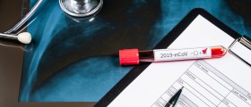 Что вы должны знать о тестировании COVID-19? Подробный обзор
