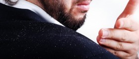 Natural remedies for Seborrheic Dermatitis (Dandruff)