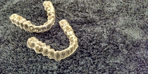 How To Straighten Your Teeth Without Braces