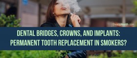 Dental Bridges, Crowns, And Implants: Permanent Tooth Replacement In Smokers?