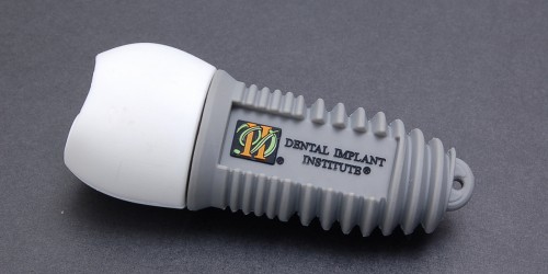 How To Know Your Dental Implant Is Failing And What To Do About It