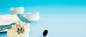 Что такое безлоскутные зубные имплантаты? Они лучше чем лоскутные имплантаты?