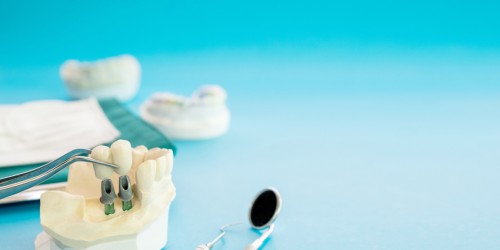 What Are Flapless Dental Implants? Are They Better Than Flap Implants?