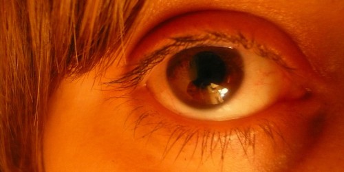 Euthanasia For Young Sex Abuse Victim: Did The Dutch Give Up Too Soon?