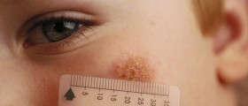 The Healthy Skin I Live In: Best Mobile Dermatology Apps for Patients and Doctors