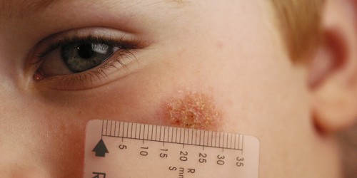 The Healthy Skin I Live In: Best Mobile Dermatology Apps for Patients and Doctors