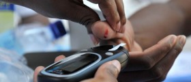 Types of Diabetic Neuropathy