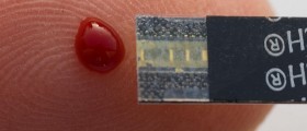 Using Enzymes To Fight Diabetic Complications
