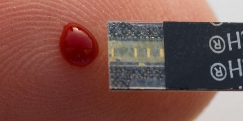 Using Enzymes To Fight Diabetic Complications