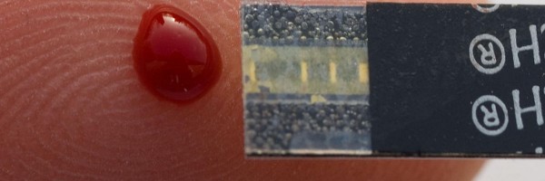 Using Enzymes To Fight Diabetic Complications