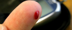 Sulfonylureas For Diabetes, Obsolete But Still Commonly Prescribed