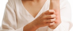 Diabetes And Skin Problems: 12 Diabetic Conditions You Need To Know About