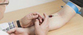 Diagnosing Arthritis With Blood Tests: What Can General And Specialized Blood Tests Reveal?