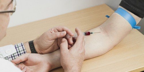 Diagnosing Arthritis With Blood Tests: What Can General And Specialized Blood Tests Reveal?