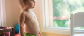 How to Treat Severe Diaper Rash At Home