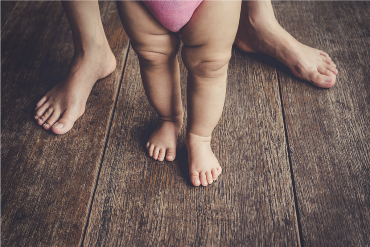 do-overweight-toddlers-start-walking-later-and-do-they-have-delayed-motor-skills-children-s