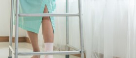 Does A History Of Broken Bones Increase Your Risk Of Being Diagnosed With Osteoporosis?